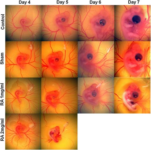 Figure 4. Retinoic acid perturbation study data set. Array of ex ovo chick images across treatment and over time. The RA treatment stunted embryo development and even resulted in embryo lethality at higher dosages.