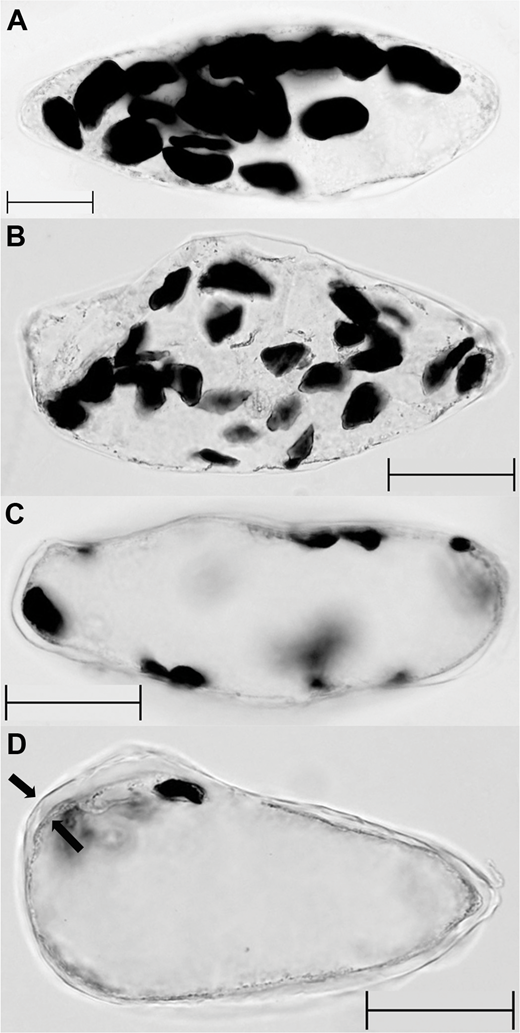 Exploring Carbohydrates with Bananas | The American Biology Teacher