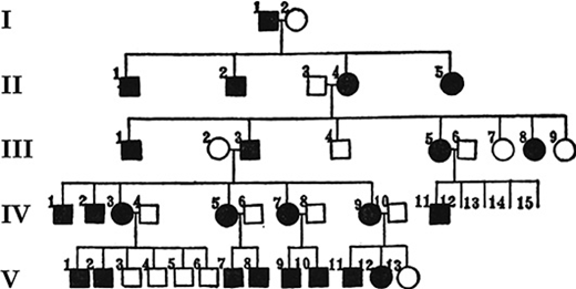 write an essay on pedigree analysis Davenport’s pedigree of a family with Huntington disease (Davenport, 1911, p. 103).