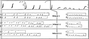 The Ocean is a Noisy Place. In addition to the long-form charts like Figure 1 above, Payne and McVay published more detailed diagrams like this one to delineate the structure of different themes and phrases within the song. The above shows the pattern of theme 3 on the left and theme 4 on the right. The top row is a generalized, schematic version of the themes’ development phrase to phrase, allowing Payne and McVay to classify units according to diagrammatic types—e.g., “the phrases in theme 3 have as their first unit a loud, ascending frequency sweep”—thus grouping the more individuated variations into the same kind. The actual tracings of individual songs from three whales underneath also compressed the information in each whale’s voice and environment, “emphasizing loud notes of the song” (p. 586)—as tracing minimized relative variations in volume—and reinserting the higher-pitched “arpeggios” that could be more clearly heard than seen on the raw spectrogram. They wrote: “The ocean is a noisy place (some of the tapes include wave noise, ship noise, dynamite blasts, and distant whales), and because loud sounds in the water are invariably followed by trains of echoes, we have isolated the whale sounds by tracing them on a separate sheet, thus omitting echoes and noise. Our tracings also exclude [most] harmonics, since they are of little or no consequence in establishing sequences and are often spuriously generated by the spectrograph” (p. 592). From Roger Payne and Scott McVay, “Songs of Humpback Whales,” Science 173, no. 3997 (1971), 593. Used with permission of the American Association for the Advancement of Science (AAAS), as conveyed through Copyright Clearance Center, Inc.